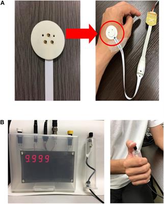Electrical Characterisation of Aδ-Fibres Based on Human in vivo Electrostimulation Threshold